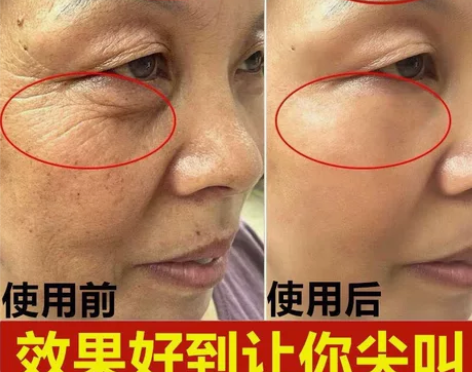 精华眼霜正品淡化眼袋黑眼圈脂肪粒细纹保湿提...