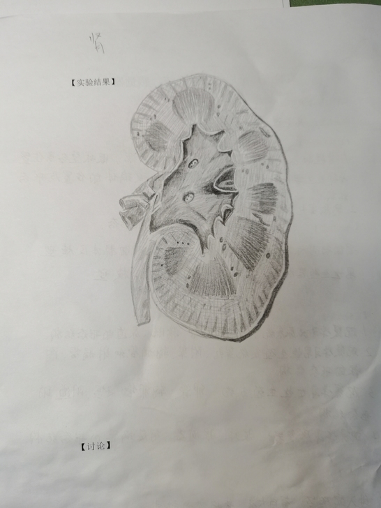 医学素描画,有需要可以来找我!