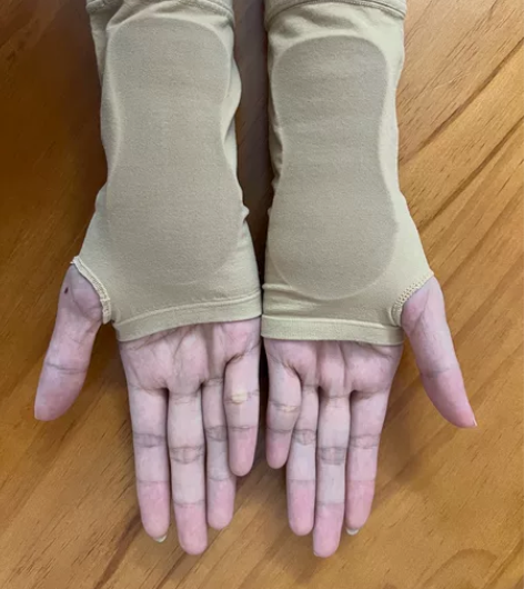 美国bungapads硅胶护掌 手掌部位硅...