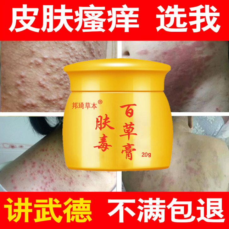 肤毒百草膏全身上红疙瘩皮肤外用止痒药屁股大...