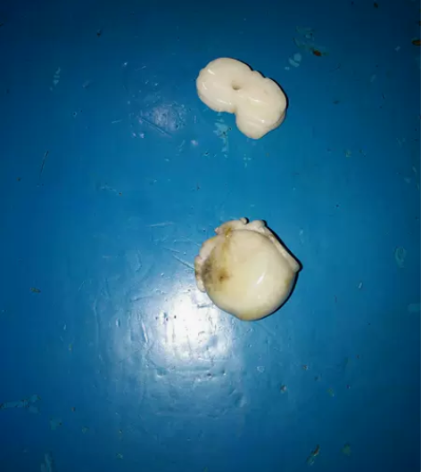 二粒玉雕，单个价，小桃子48元，重23克，...