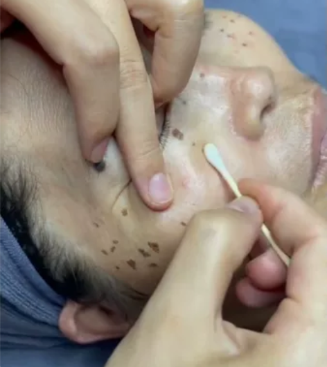 斑到底给你的生活带来了怎么样的影响 ①生活...