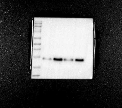 WB/western blot/聚丙烯酰胺...