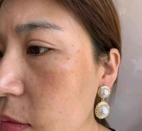 南京同仁堂淡斑精华好用，淡斑效果很好 感兴...