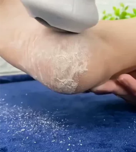 库存囤多了!全新包邮!这个电动磨脚器早一天...